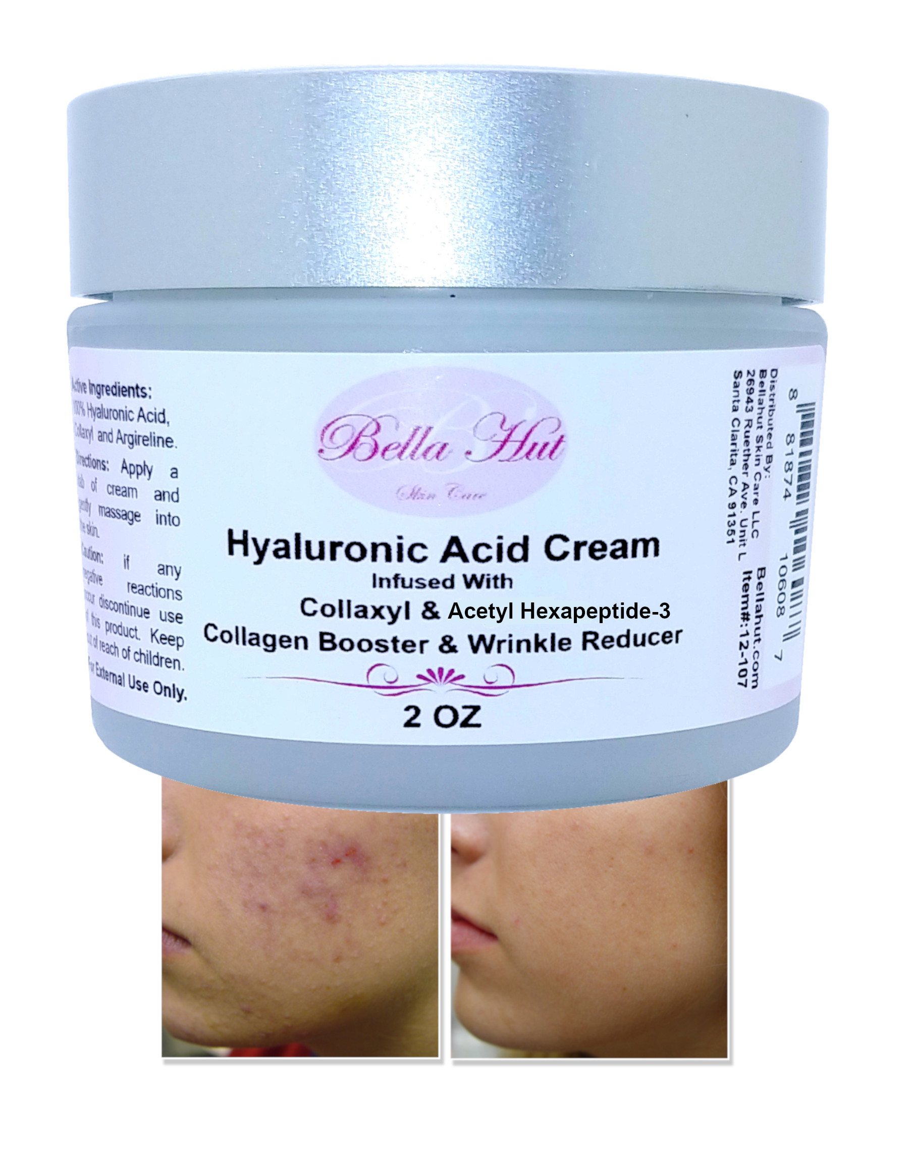 100% Hyaluronic Acid Cream with Collaxyl and Acetyl hexapeptide-3 