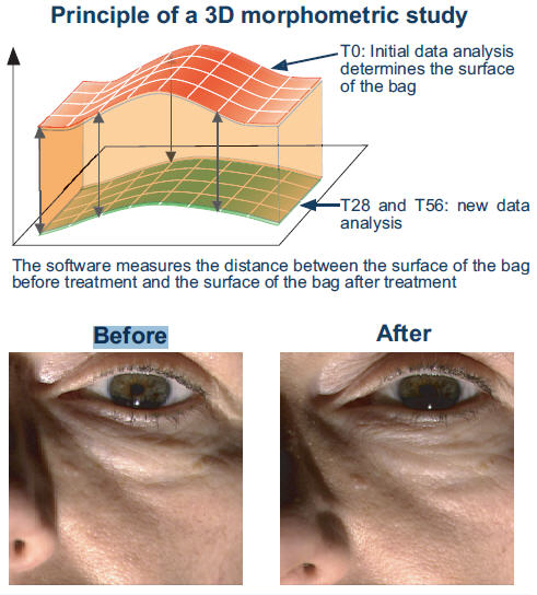 Triple Rejuvenating Eye Gel with Eyeliss for treating under eye bags and puffiness under eyes