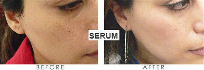 /A skin care serum that helps to protect against UV and boosts collagen and more