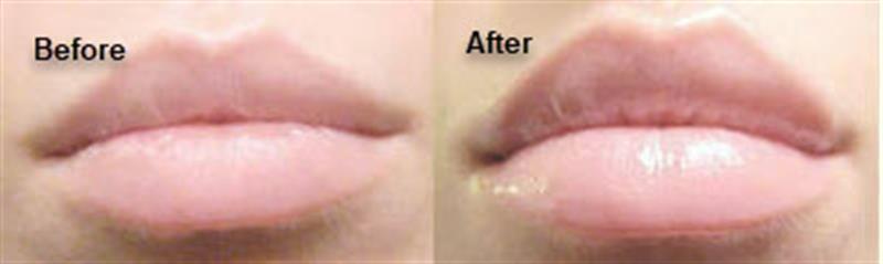 /A peptide complex to add to a cream that increases lip volume