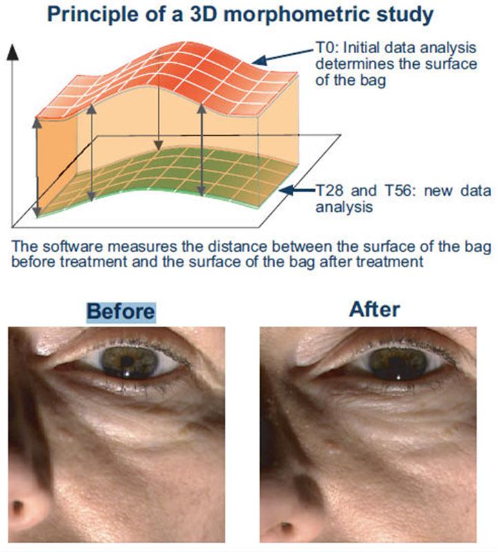 /Triple Rejuvenating Eye Gel with Eyeliss for treating under eye bags and puffiness under eyes