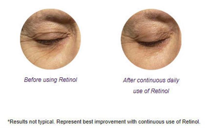 /Bellahut 2.5% Retinol Serum