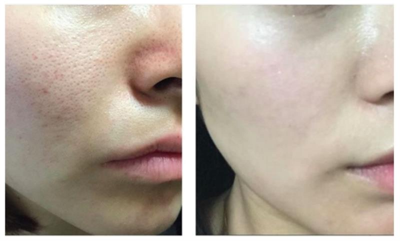 /A raw peptide that is used to mix into creams and serums to make anti aging products