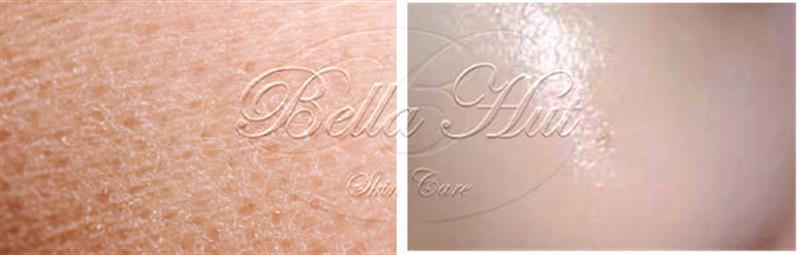 /A raw peptide that is used to mix into creams and serums to make anti aging products