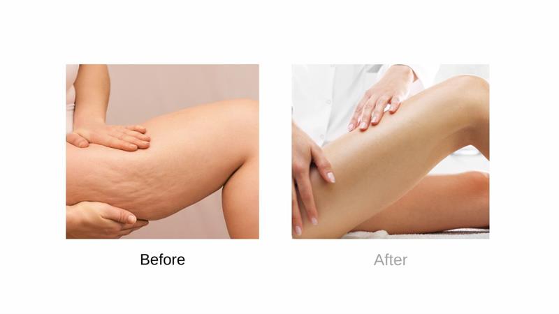 /BODY FIRMING & CONTOURING